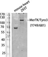 MerTK/Tyro3 (phospho Tyr749/681) Polyclonal Antibody