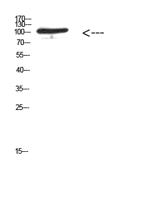 MER/TYRO3 (Phospho Tyr753/Tyr685) Polyclonal Antibody