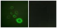 Met (phospho Tyr1003) Polyclonal Antibody