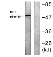 MITF (phospho Ser180) Polyclonal Antibody