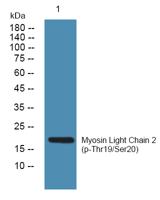 MLC-2 (phospho Thr17/S18) Polyclonal Antibody