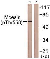 Moesin/Ezrin/Radixin (phospho Thr558) Polyclonal Antibody