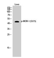 MOR-1 (phospho Ser375) Polyclonal Antibody