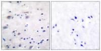 MOR-1 (phospho Ser375) Polyclonal Antibody