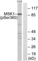 MSK1 (phospho Ser360) Polyclonal Antibody