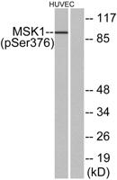 MSK1 (phospho Ser376) Polyclonal Antibody