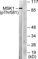 MSK1 (phospho Thr581) Polyclonal Antibody