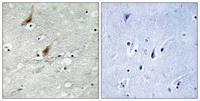 MSK2 (phospho Thr568) Polyclonal Antibody