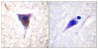 mTOR (phospho Ser2481) Polyclonal Antibody