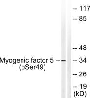 Myf-5 (phospho Ser49) Polyclonal Antibody