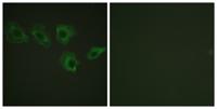 MYPT1 (phospho Thr696) Polyclonal Antibody