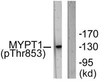 MYPT1 (phospho Thr853) Polyclonal Antibody