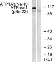 Na+/K+-ATPase α1 (phospho Ser23) Polyclonal Antibody