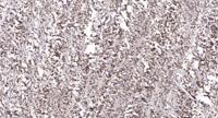 NACA (phospho Ser43) Polyclonal Antibody