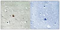 Nek9 (phospho Thr210) Polyclonal Antibody