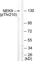 Nek9 (phospho Thr210) Polyclonal Antibody