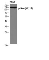 HER2 (phospho Tyr1112) Polyclonal Antibody