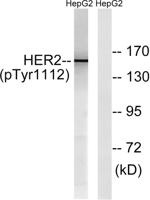 HER2 (phospho Tyr1112) Polyclonal Antibody