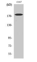 HER2 (phospho Tyr1221/Y1222) Polyclonal Antibody