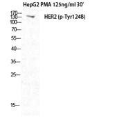 HER2 (phospho Tyr1248) Polyclonal Antibody