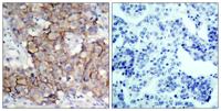 HER2 (phospho Tyr877) Polyclonal Antibody