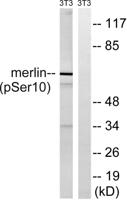 NF2 (phospho Ser10) Polyclonal Antibody