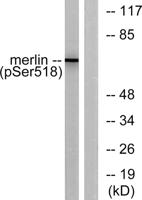 NF2 (phospho Ser518) Polyclonal Antibody