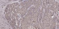 NFAT5 (phospho Ser155) Polyclonal Antibody