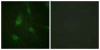 NFATc3 (phospho Ser165) Polyclonal Antibody