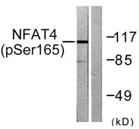 NFATc3 (phospho Ser165) Polyclonal Antibody