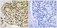 NFATc4 (phospho Ser168/S170) Polyclonal Antibody