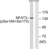 NFATc4 (phospho Ser168/S170) Polyclonal Antibody