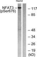 NFATc4 (phospho Ser676) Polyclonal Antibody