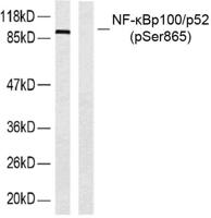 NFκB-p100 (phospho Ser865) Polyclonal Antibody