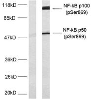 NFκB-p100 (phospho Ser869) Polyclonal Antibody