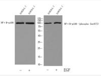 NFκB-p100 (phospho Ser872) Polyclonal Antibody