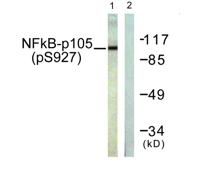 NFκB-p105 (phospho Ser927) Polyclonal Antibody