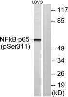 NFκB-p65 (phospho Ser311) Polyclonal Antibody