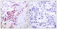 NFκB-p65 (phospho Ser468) Polyclonal Antibody