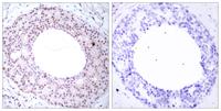 NFκB-p65 (phospho Thr254) Polyclonal Antibody