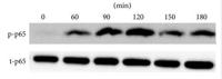 NFκB-p65 (phospho Thr505) Polyclonal Antibody