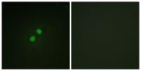 Nibrin (phospho Ser278) Polyclonal Antibody