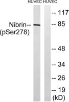 Nibrin (phospho Ser278) Polyclonal Antibody