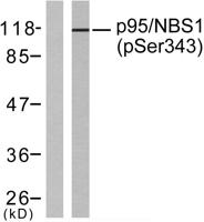 Nibrin (phospho Ser343) Polyclonal Antibody