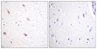 NIFK (phospho Thr234) Polyclonal Antibody