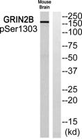 NMDAε2 (phospho Ser1303) Polyclonal Antibody