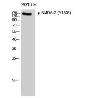 NMDAε2 (phospho Tyr1336) Polyclonal Antibody