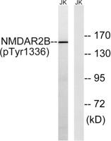 NMDAε2 (phospho Tyr1336) Polyclonal Antibody