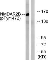 NMDAε2 (phospho Tyr1474) Polyclonal Antibody