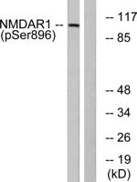 NMDAζ1 (phospho Ser896) Polyclonal Antibody